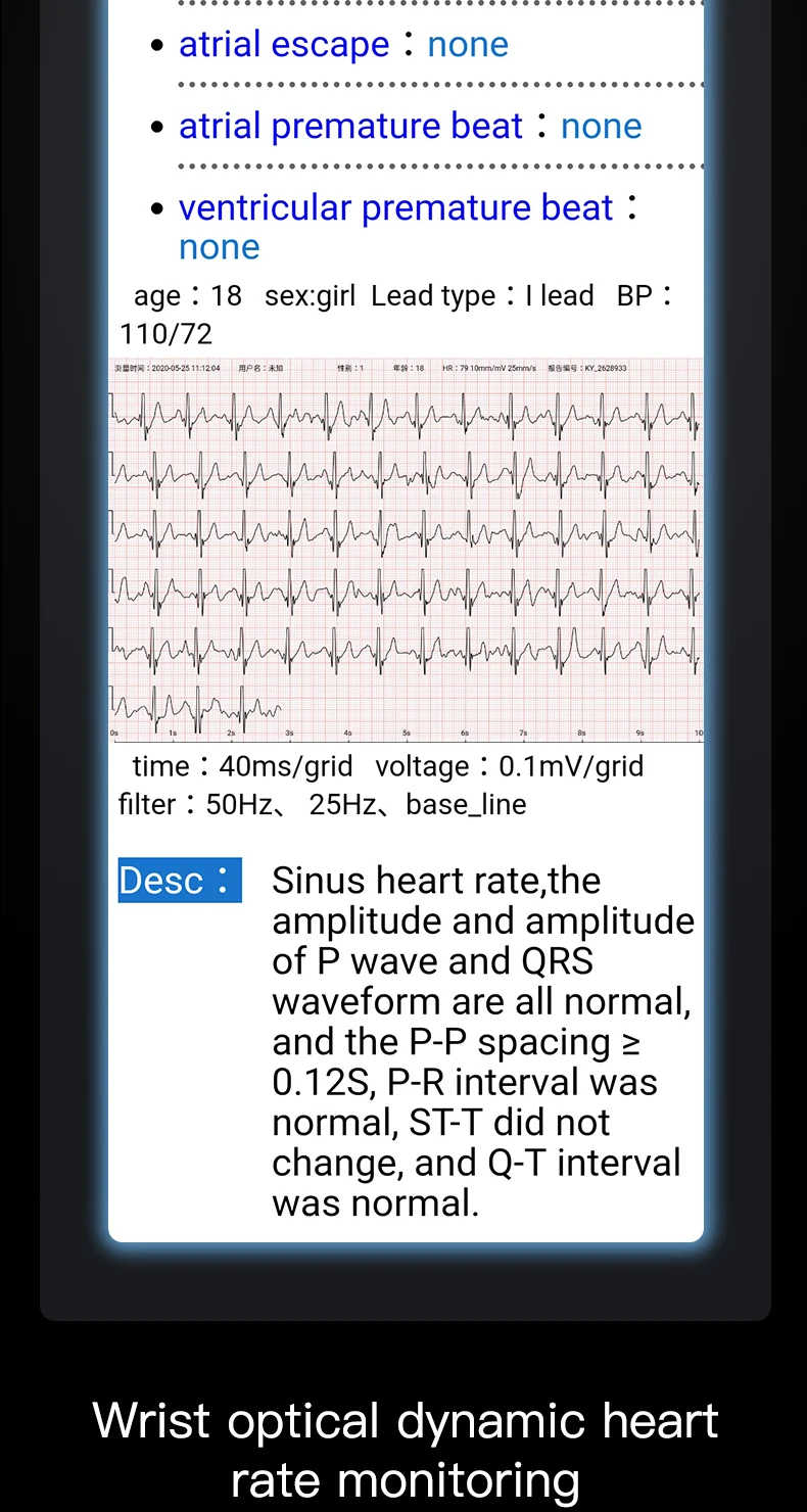P11Plus Smart Health Fitness Tracker Wristband with ECG, PPG, Calorie, and Blood Pressure Monitoring